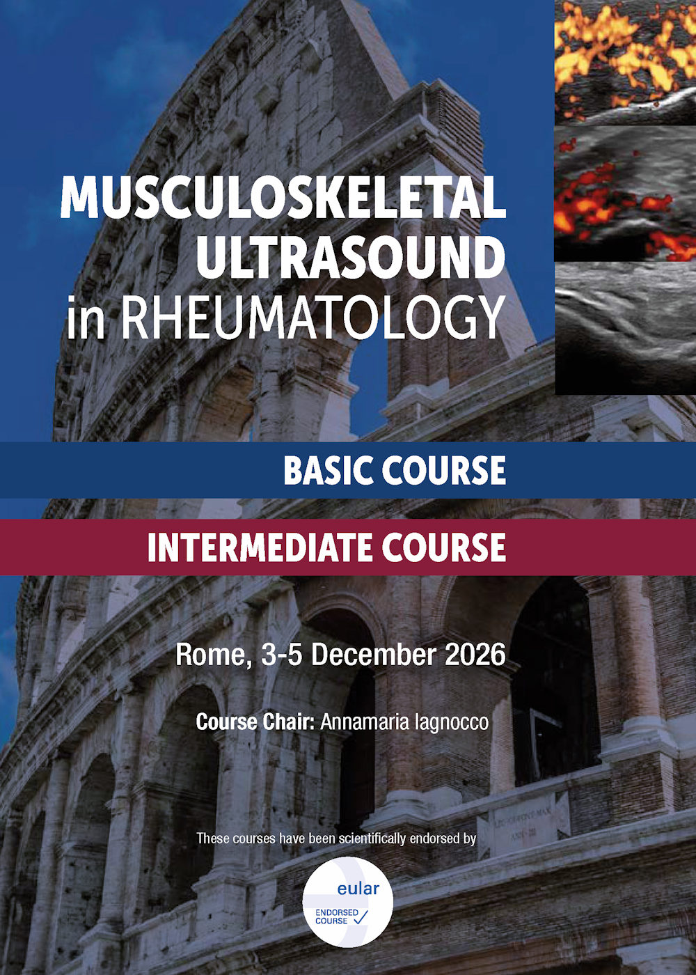 Musculoskeletal Ultrasound in Rheumatology 2026